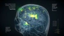 My Brilliant Brain show