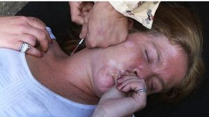 Heroin photo