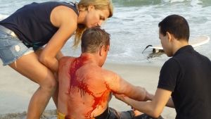 Shark Attack Victims photo