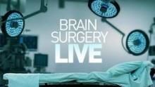 Brain Surgery Live!  show