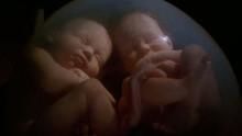 In The Womb: Identical Twins show