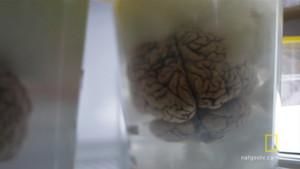 The Brain Collector photo